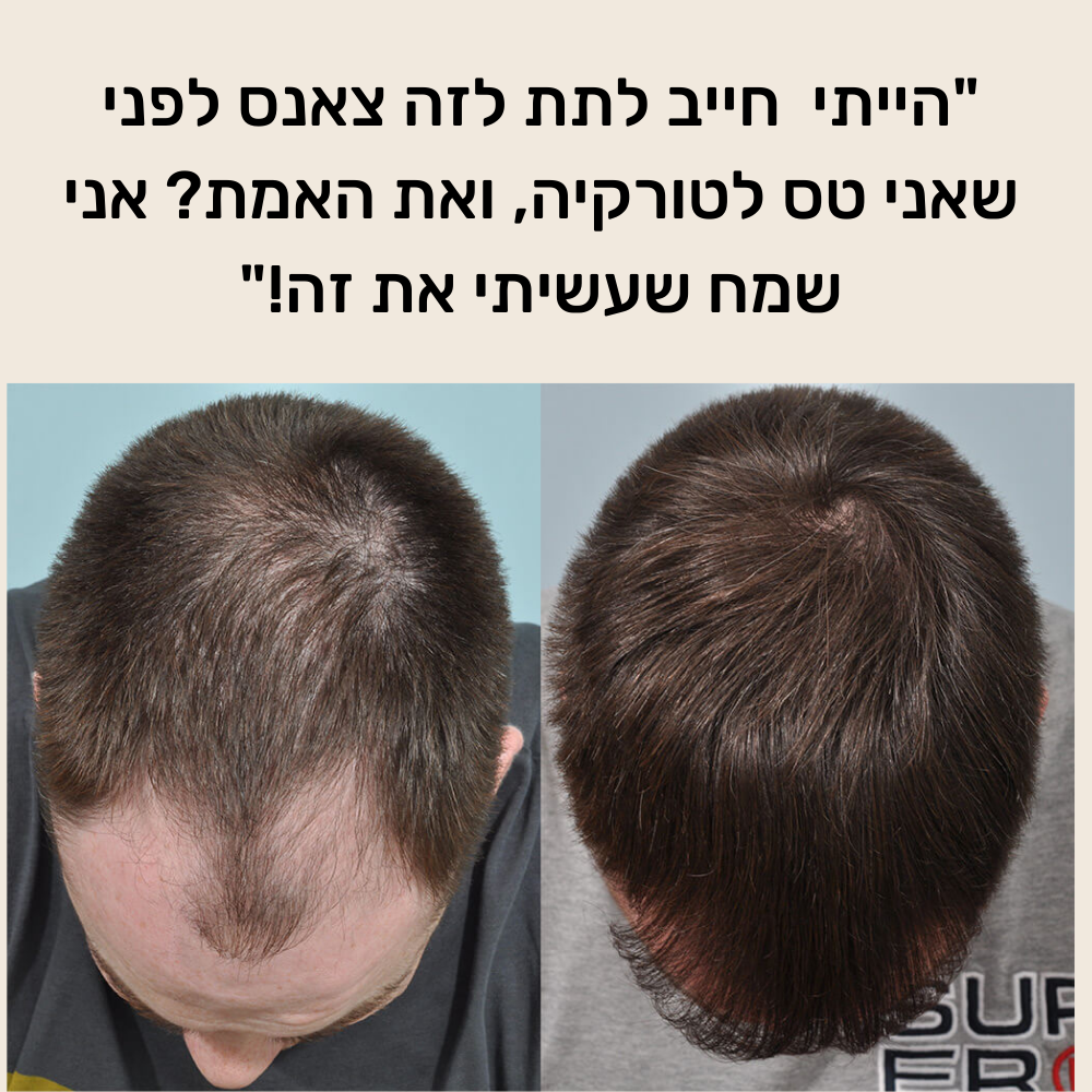 HairBoost - רולר לצמיחת שיער הראש